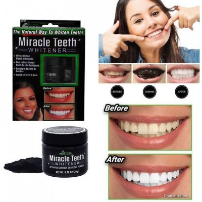 Miracle Teeth na bělení zubů 20 g – Zbozi.Blesk.cz