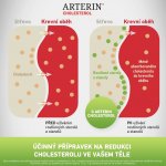 Arterin Cholesterol 90 tablet – Hledejceny.cz