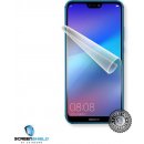 Ochranná fólie Screenshield HUAWEI P20 Lite - displej