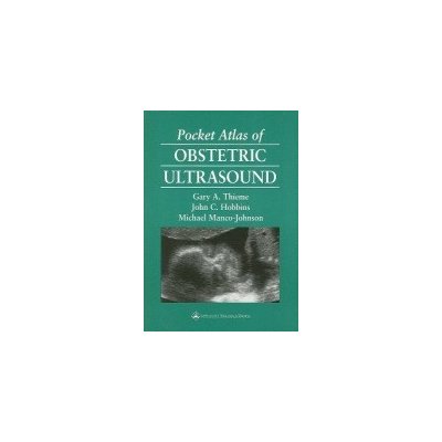 Pocket Atlas of Obstetric Ultrasound Thieme Gary A.Paperback