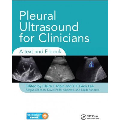 Pleural Ultrasound for Clinicians – Zboží Mobilmania