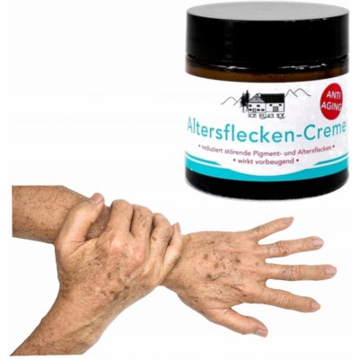 Vom Pullach Hof 0 SPF Krém proti pigmentovým skvrnám na obličej 50 ml – Zboží Dáma