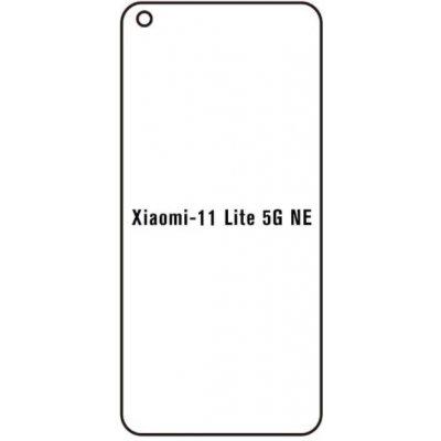 Ochranná fólie Hydrogel Xiaomi 11 lite 5G NE – Zboží Mobilmania