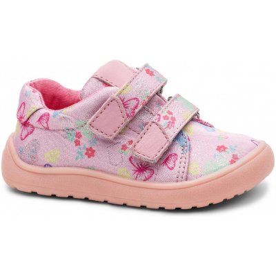 Protetika Koro Butterfly – Sleviste.cz