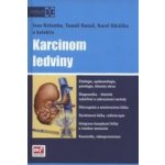 Karcinom ledviny + DVD - doc. MUDr. Karel Odrážka, Ph.D. – Hledejceny.cz