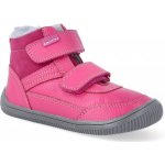 Protetika Tyrel Koral – Zboží Dáma