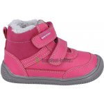 Protetika Tyrel Koral – Zboží Dáma