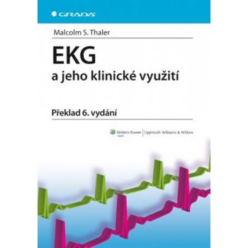 EKG