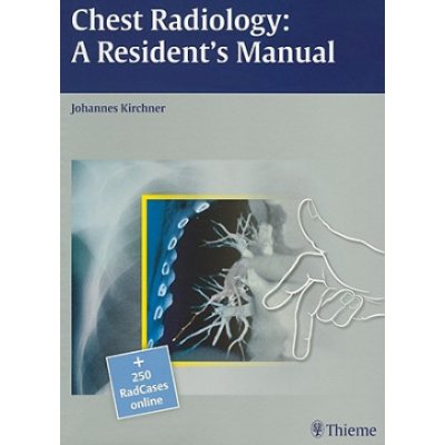 Chest Radiology: A Resident's Manual