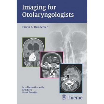 Imaging for Otolaryngologists - Dunnebier, Erwin A.