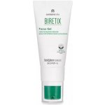 Biretix Focus Gel zklidňující gel na pleť se sklonem k akné 15 ml – Zboží Dáma