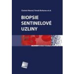 Biopsie sentinelové uzliny Čestmír Neoral – Hledejceny.cz