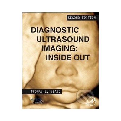 Diagnostic Ultrasound Imaging: Inside Out Szabo Thomas – Hledejceny.cz