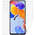 Ochranná fólie ScreenShield XIAOMI Redmi Note 11 Pro 5G - celé tělo – Hledejceny.cz