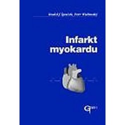 Infarkt myokardu