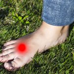 VV Design BON PED+ Mortonova noha – Zboží Dáma