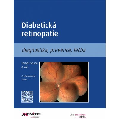 Diabetická retinopatie - Tomáš Sosna, kol.