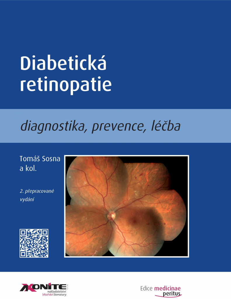 Diabetická retinopatie - Tomáš Sosna, kol.