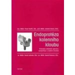 Endoprotéza kolenního kloubu -- Průvodce obdobím operace, rehabilitací a dalším životem. Pavel Vavřík, Antonín Sosna – Hledejceny.cz