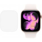 RedGlass Fólie Apple Watch Series 11 (42 mm) 6 ks 144025 – Sleviste.cz