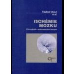 Ischémie mozku – Sleviste.cz