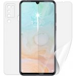 Ochranná fólie Screenshield DOOGEE N20 Pro - celé tělo – Hledejceny.cz