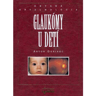 Glaukómy u detí - Anton Gerinec – Hledejceny.cz