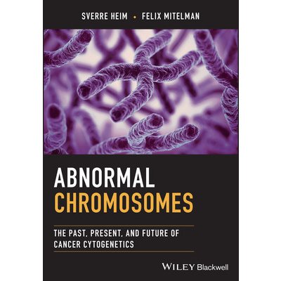 Abnormal Chromosomes – Zboží Mobilmania