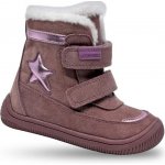 Protetika Linet růžová – Hledejceny.cz