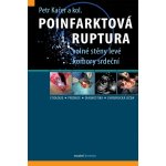 Poinfarktová ruptura – Zbozi.Blesk.cz