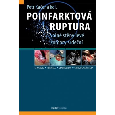 Poinfarktová ruptura