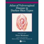 Atlas of Vulvovaginal Disease in Darker Skin Types – Hledejceny.cz