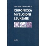 CHRONICKÁ MYELOIDNÍ LEUKEMIE – Hledejceny.cz
