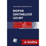Biopsie sentinelové uzliny – Hledejceny.cz