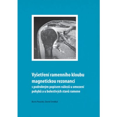 Vyšetření ramenního kloubu magnetickou rezonancí s podrobným popisem nálezů u omezení pohybů u bolestivých stavů ramene - Boris Pauček, David Smékal – Zbozi.Blesk.cz