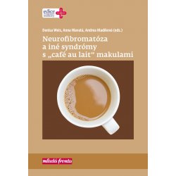Neurofibromatóza a iné syndromy s „café au lait“ makulami - Andrea Hladíková, Anna Hlavatá, Denisa Weis