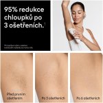 Braun IPL Silk-expert Pro 5 PL5431 – Hledejceny.cz