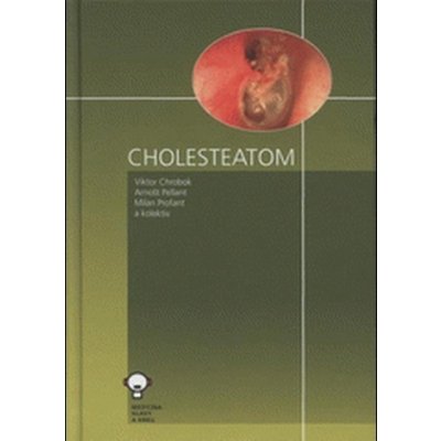 Cholesteatom - Viktor Chrobok