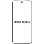 Ochranná fólie Hydrogel Umidigi Bison Pro – Zboží Živě