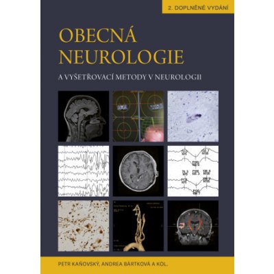 Obecná neurologie a vyšetřovací metody v neurologii - Petr Kaňovský, Andrea Bártková – Hledejceny.cz