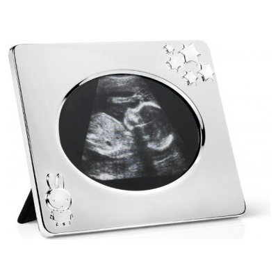 Rámeček na snímek z ultrazvuku MIFFY - Zilverstad