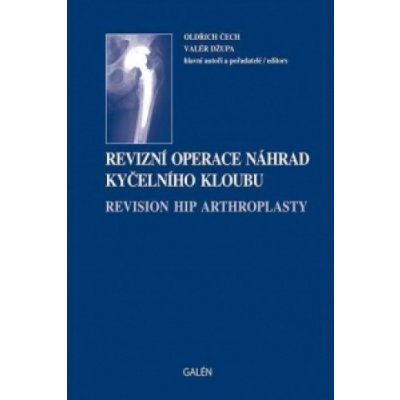 Revizní operace náhrad kyčelního kloubu – Zboží Mobilmania