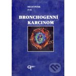 Bronchogenní karcinom Miloš Pešek et al. – Hledejceny.cz