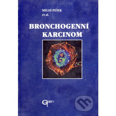 Bronchogenní karcinom Miloš Pešek et al.