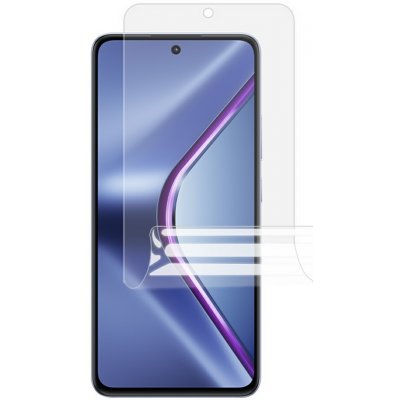 Ochranná fólie Hydrogel Realme GT 5G – Zboží Živě