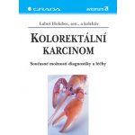 Kolorektální karcinom - Holubec Luboš, kolektiv – Hledejceny.cz