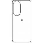 Ochranná folie engaroGuard Hydrogel zadní Honor 90 průsvitná – Zboží Živě