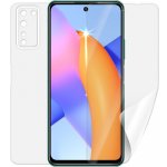 Ochranná fólie Screenshield HUAWEI Honor 10X Lite - celé tělo – Zbozi.Blesk.cz