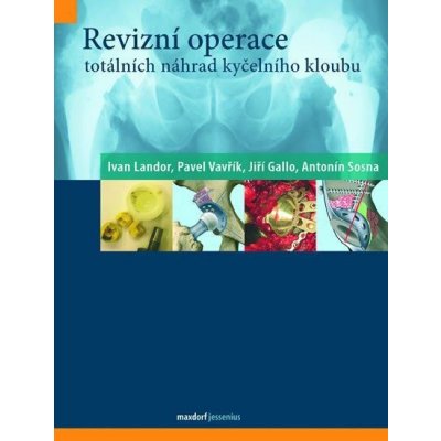 Revizní operace totálních náhrad kyčelního kloubu - Ivan Landor, Pavel Vavřík, Jiří Gallo, Antonín Sosna – Zboží Mobilmania