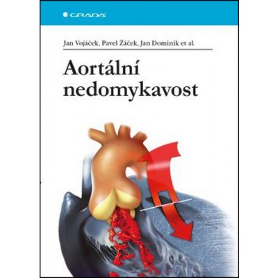 Aortální nedomykavost - Jan Vojáček, Pavel Žáček – Zboží Mobilmania